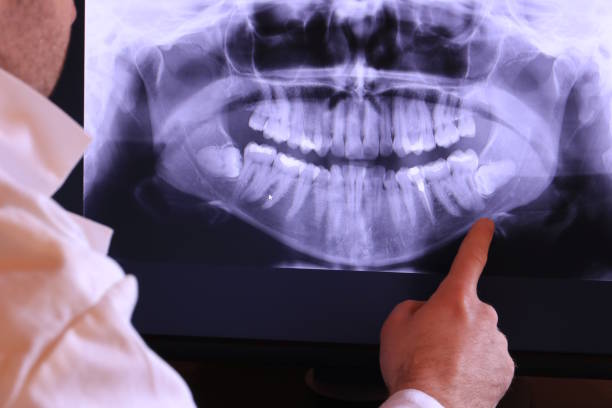 Best Emergency Root Canal Treatment in Plymouth, NC